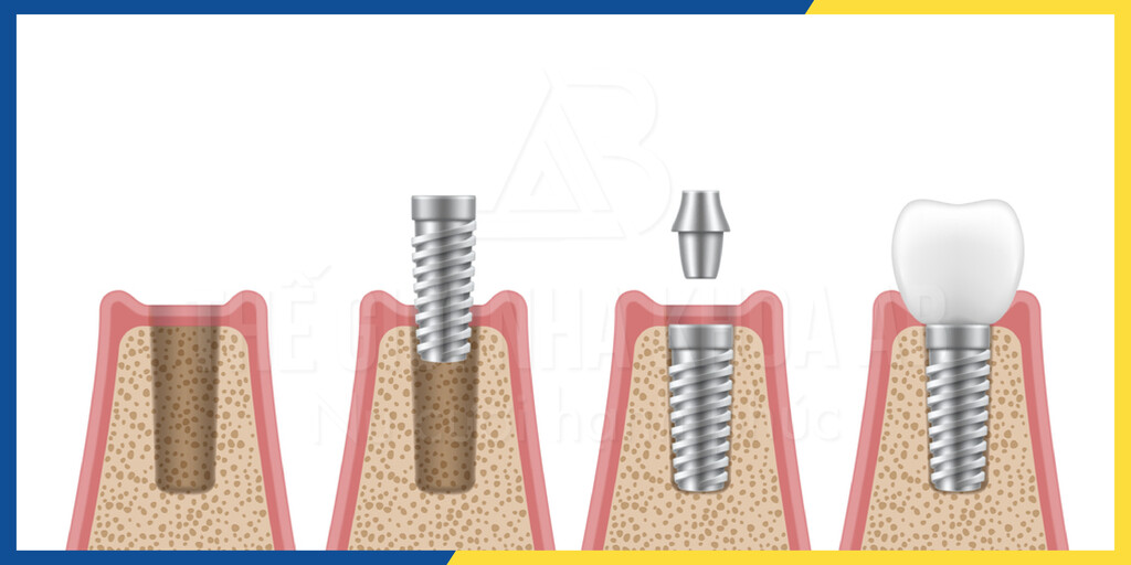Thế giới nha khoa AB