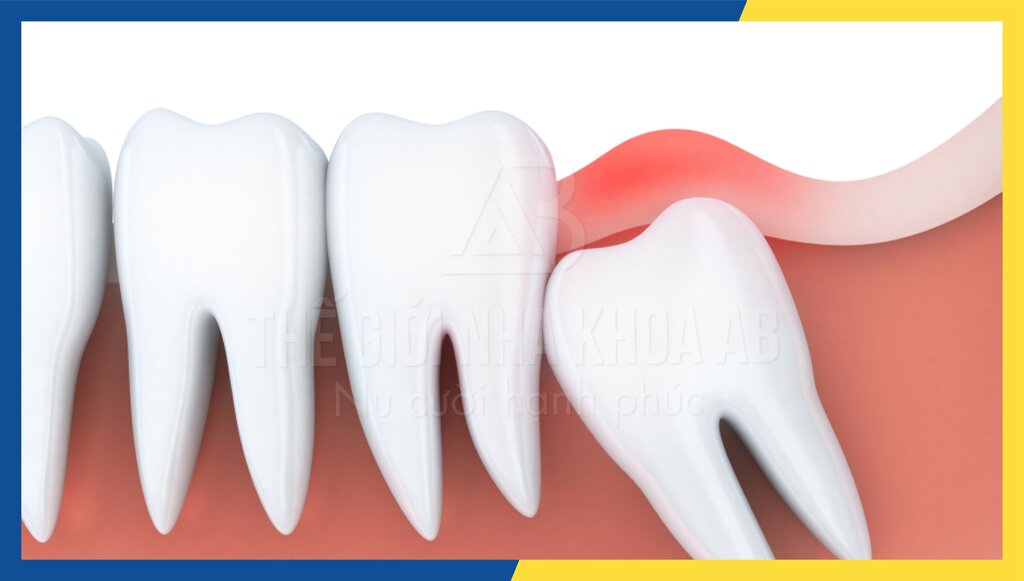 Thế giới nha khoa AB