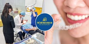 nieng-rang-bao-lau-thi-tai-kham