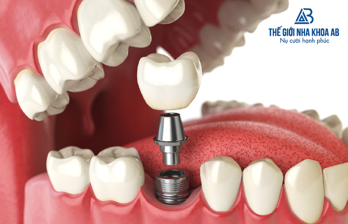 Thế giới nha khoa AB