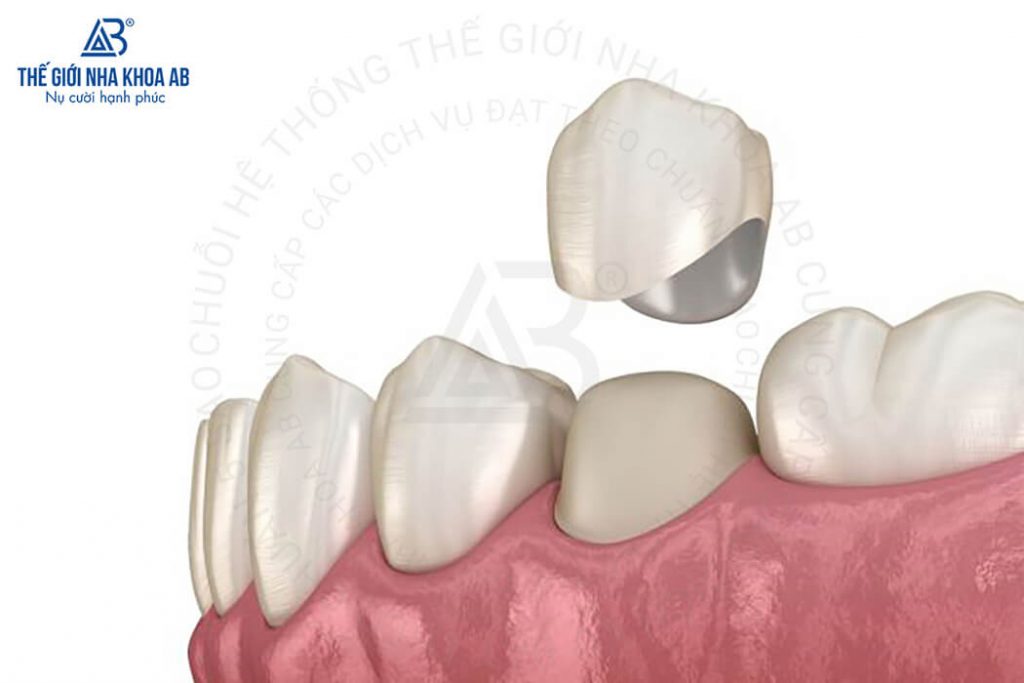 Thế giới nha khoa AB