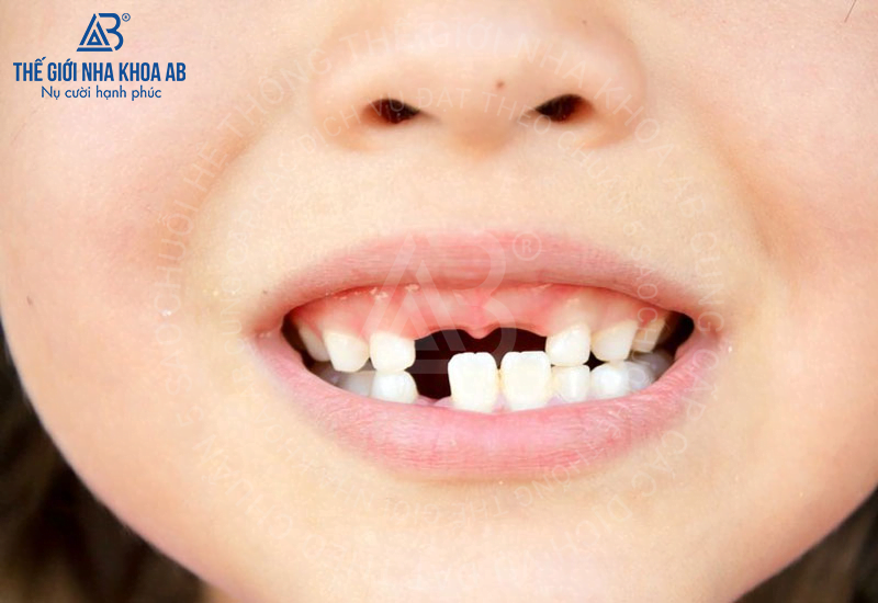 Thế giới nha khoa AB