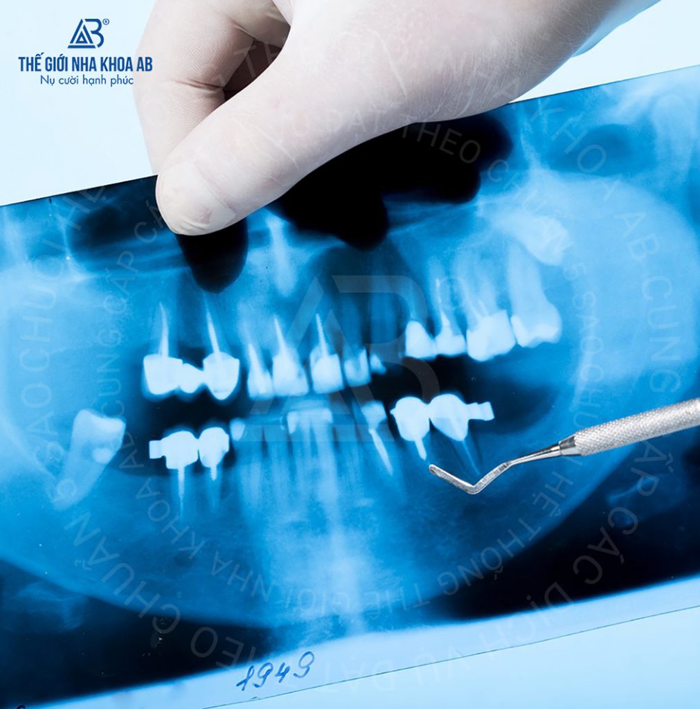 Thế giới nha khoa AB