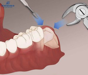 Co Nen Nho Rang Khon 1