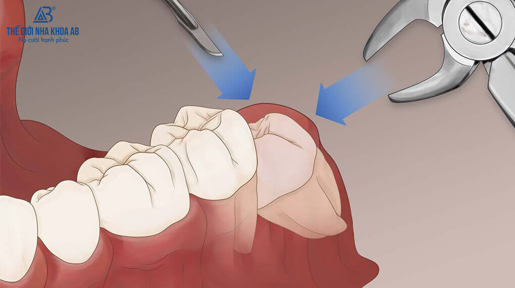 Thế giới nha khoa AB