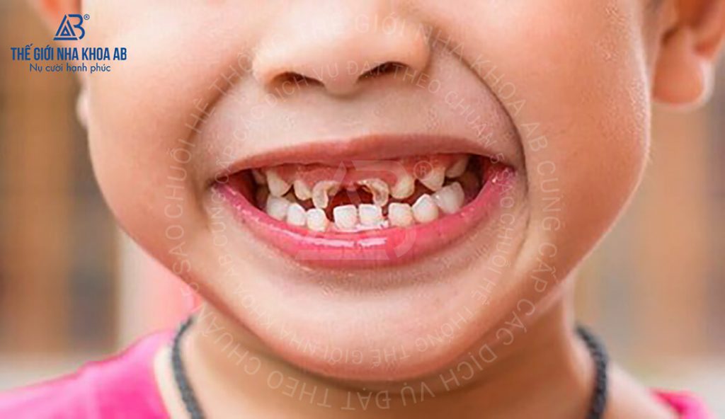Thế giới nha khoa AB