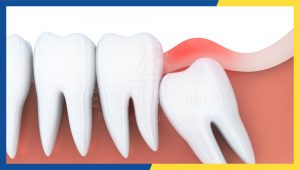 Nhung Dieu Ban Nen Biet Ve Rang Khon