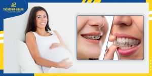 Nieng Rang Khi Mang Thai Va Nhung Dieu Can Luu Y