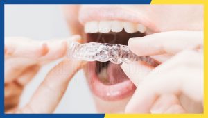 Nieng Rang Tang Hinh Tu Tin La Chinh Minh