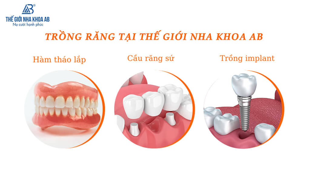 Trồng răng ở phòng khám nha khoa gần đây tại TP. Hồ Chí Minh Phong-kham-nha-khoa-gan-day-5