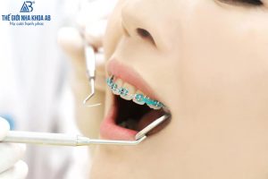 Qua Trinh Nieng Rang