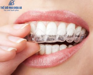 Qua Trinh Nieng Rang 4