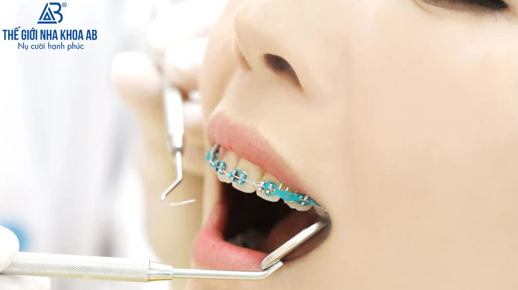 Thế giới nha khoa AB