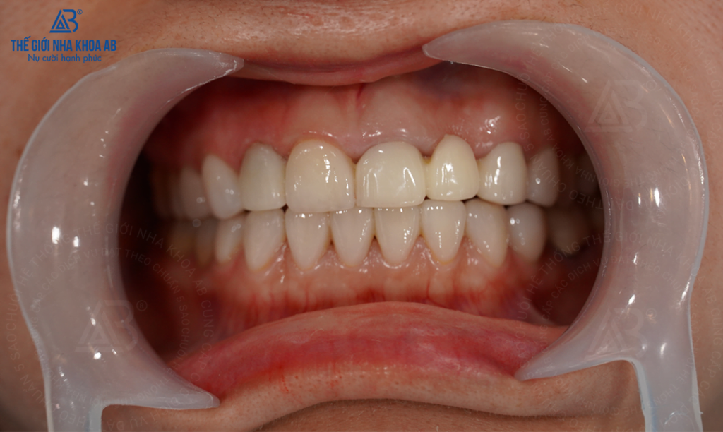 Thế giới nha khoa AB