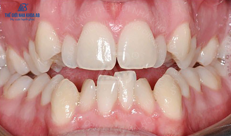 Thế giới nha khoa AB