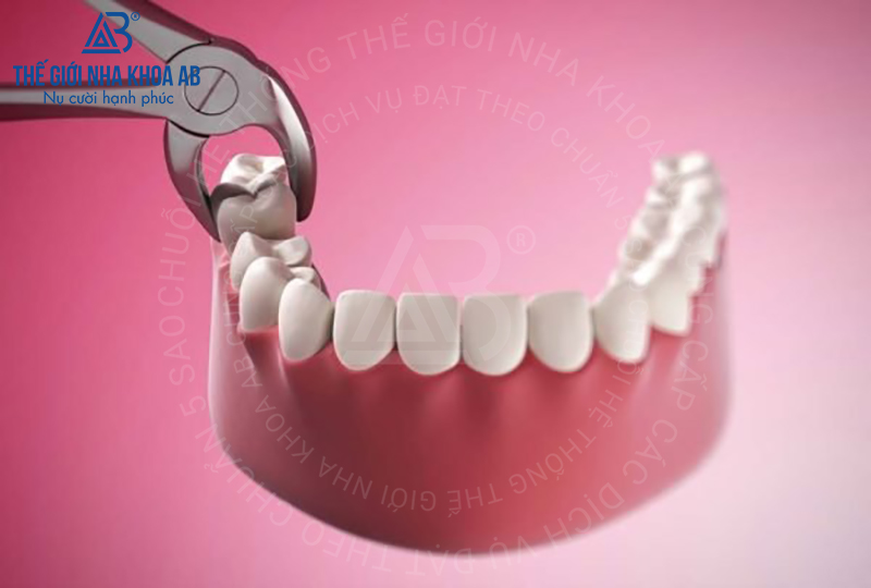 Thế giới nha khoa AB