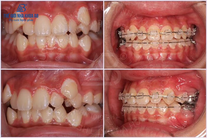 Thế giới nha khoa AB