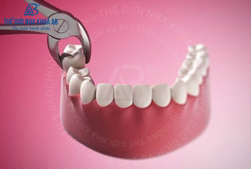 Thế giới nha khoa AB