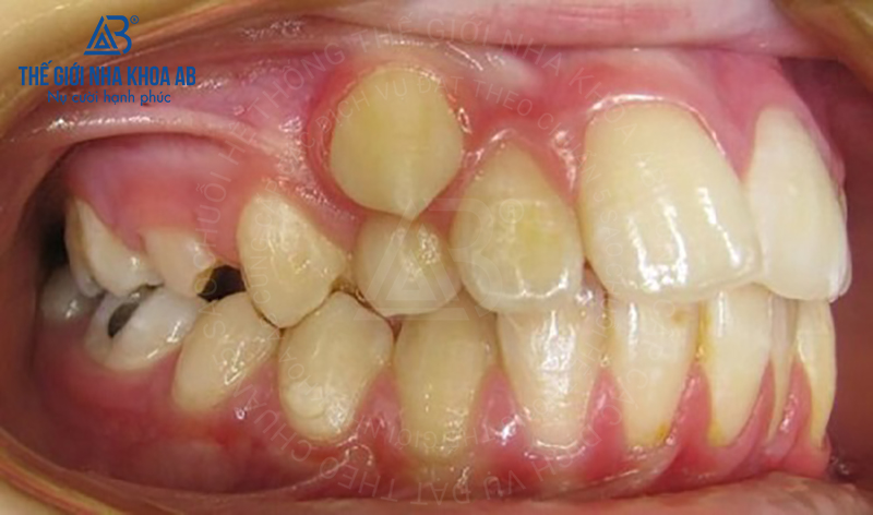 Thế giới nha khoa AB