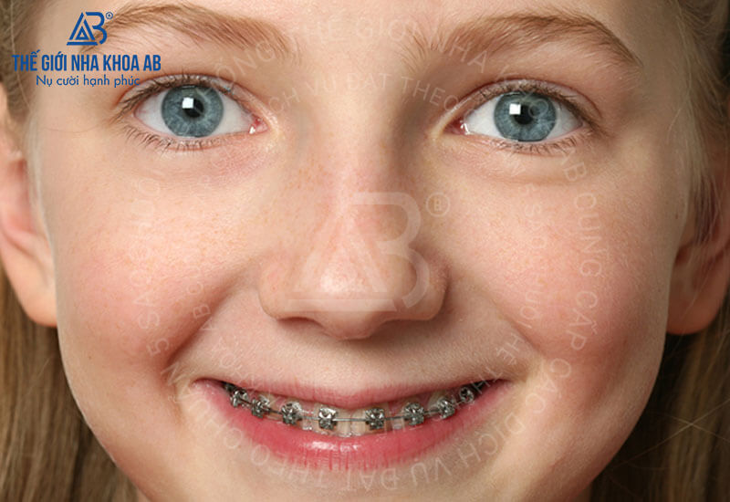 Thế giới nha khoa AB