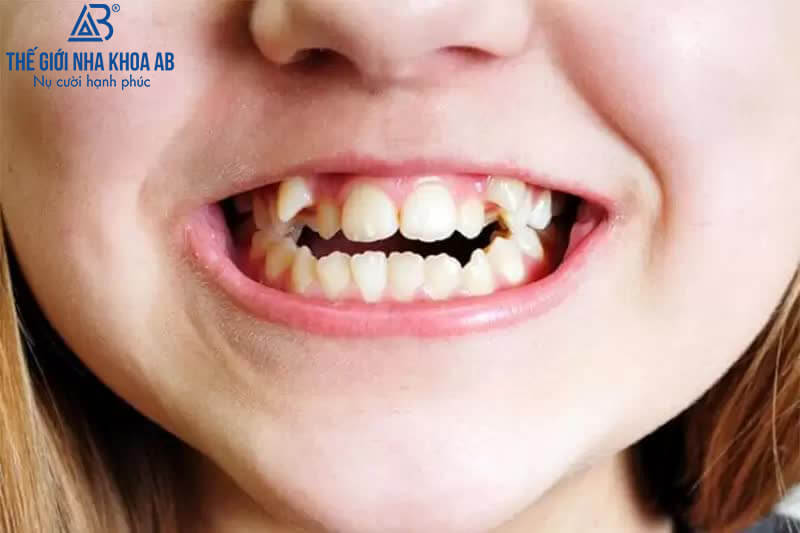 Thế giới nha khoa AB