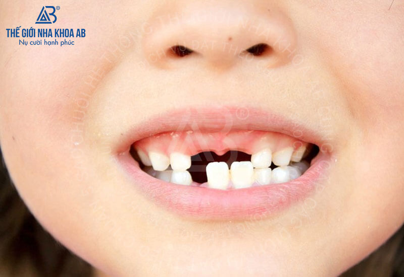 Thế giới nha khoa AB
