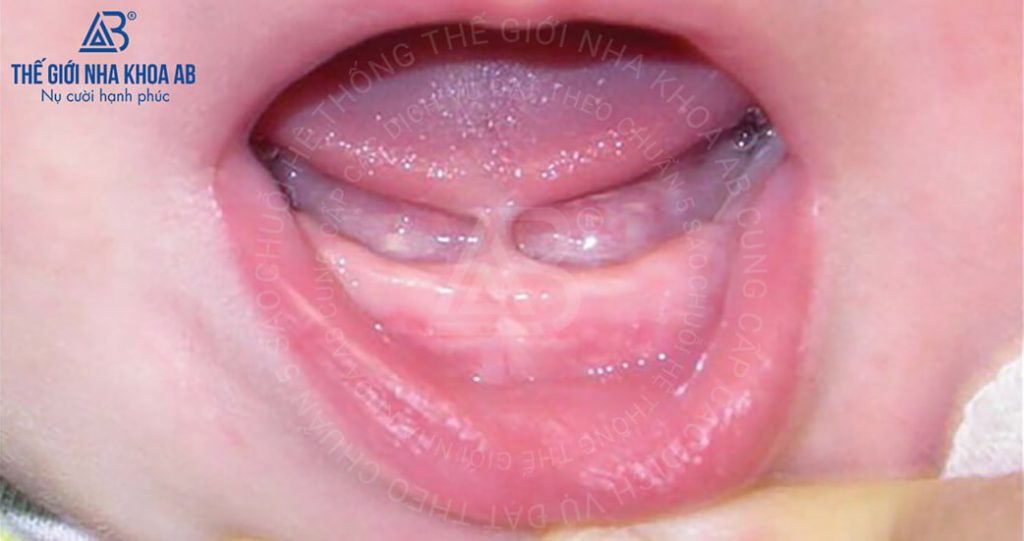 Thế giới nha khoa AB