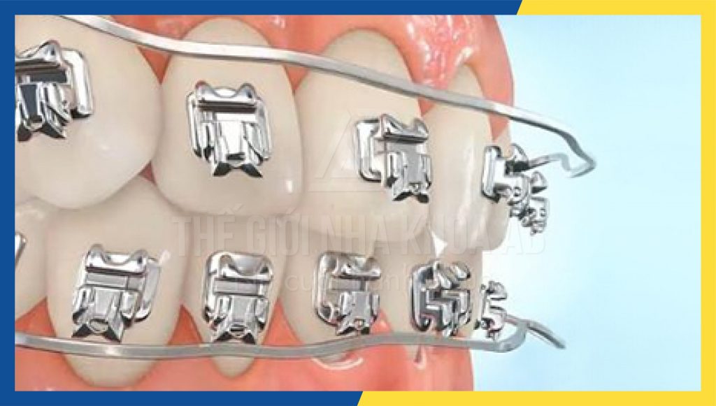 Thế giới nha khoa AB