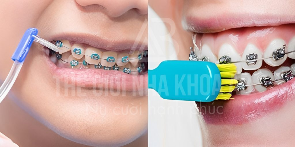 Thế giới nha khoa AB