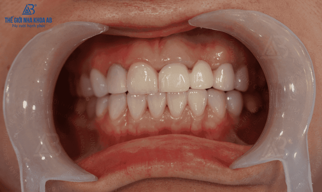 Thế giới nha khoa AB