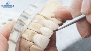 quy-trinh-che-tac-rang-su