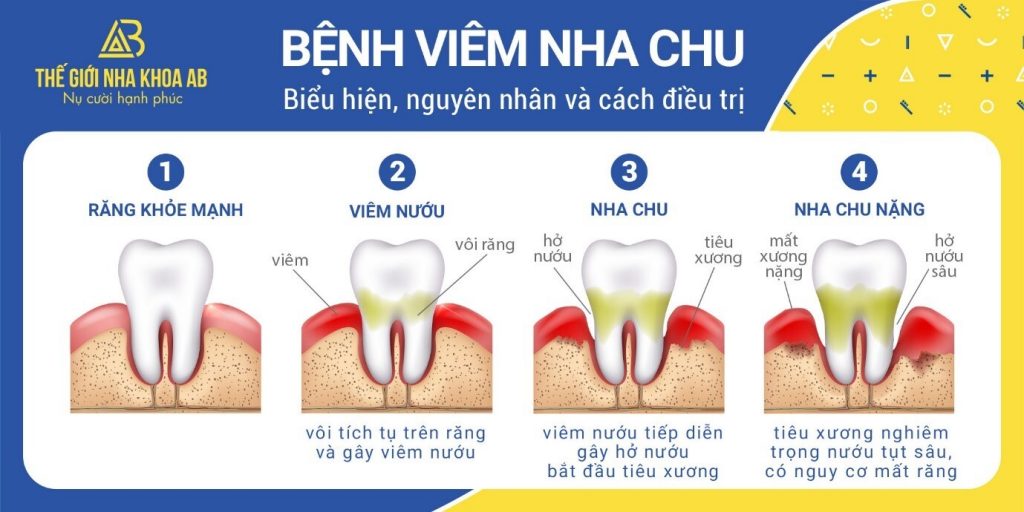 Thế giới nha khoa AB