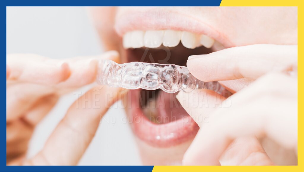 Thế giới nha khoa AB