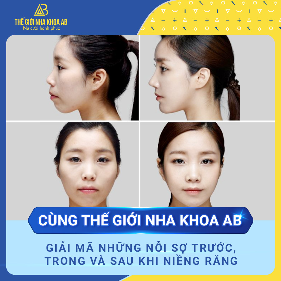 Thế giới nha khoa AB