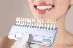 Do Mau Tay Trang Rang