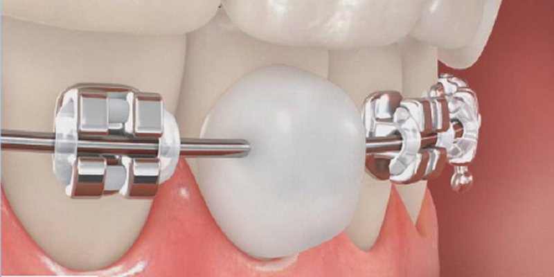 Thế giới nha khoa AB