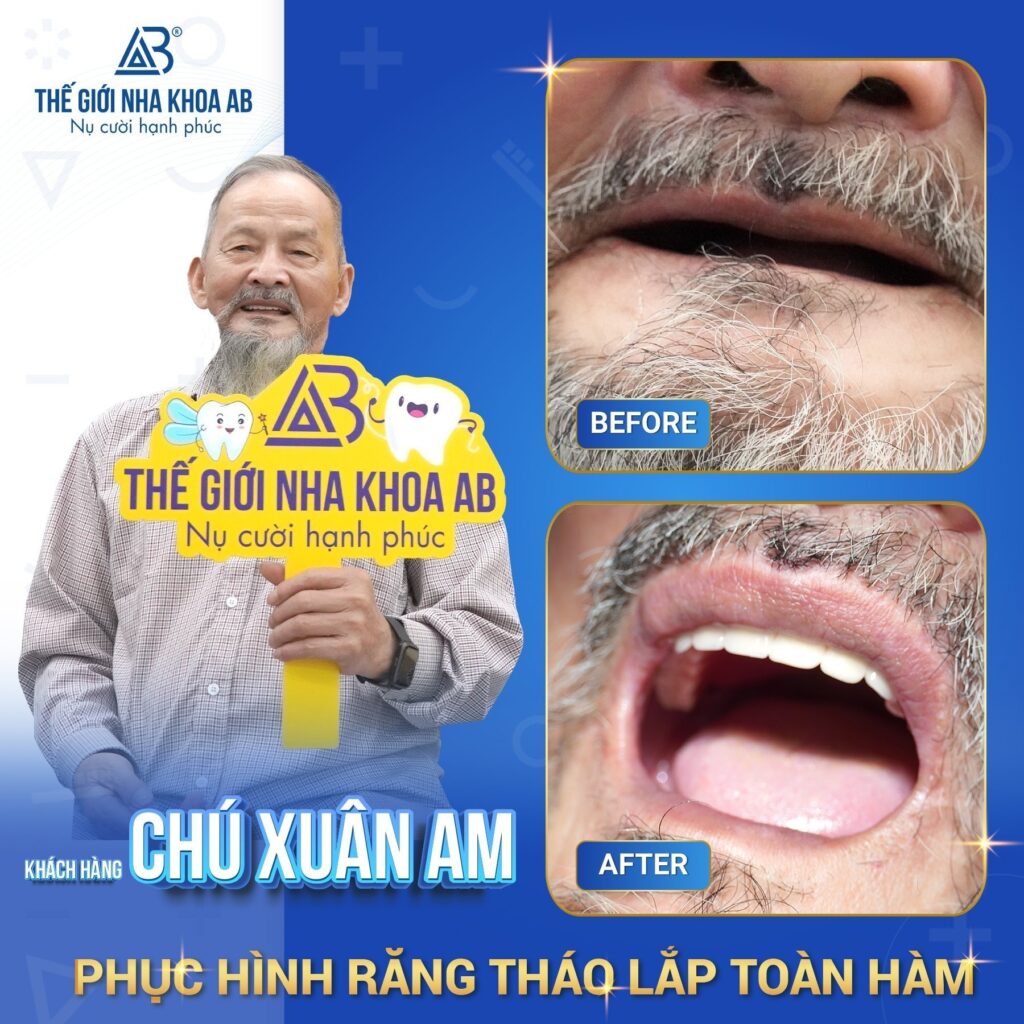Thế giới nha khoa AB