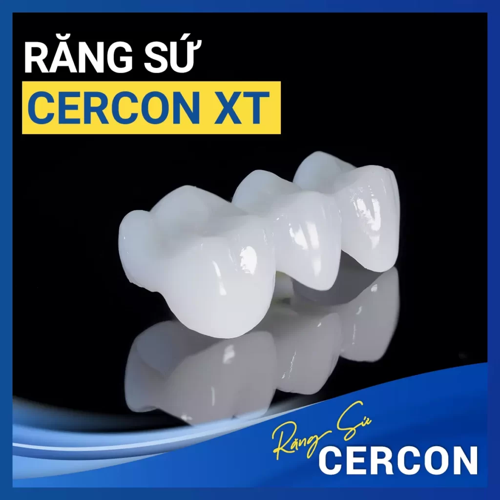 Rang Su Cercon Xt