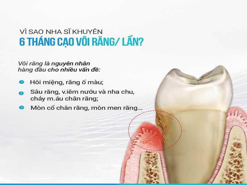 Ly Do Nen Cao Voi Rang