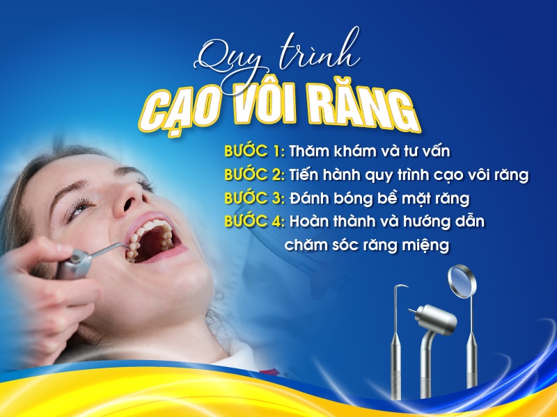 Quy Trinh Cao Voi Rang