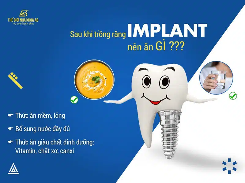 Sau Khi Trong Rang Implant Nen An Gi