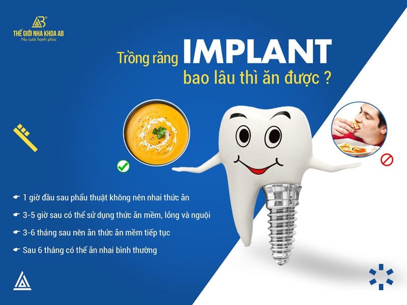 Trong Rang Implant Bao Lau Thi An Duoc