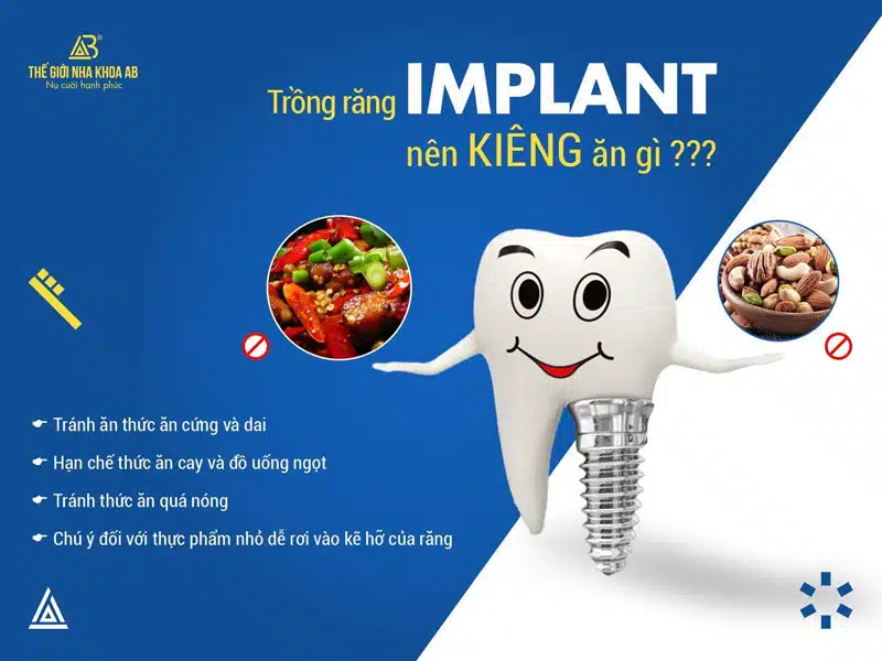 Trong Rang Implant Nen Kieng An Gi