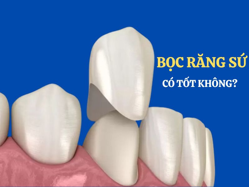 Boc Rang Su Co Tot Khong