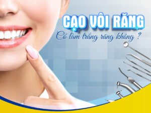 Cao Voi Rang Co Lam Trang Rang Khong