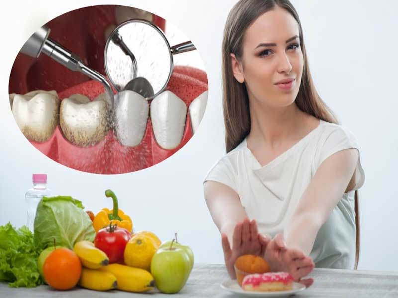 Cao Voi Rang Nen ăn Gi Và Kieng An Gi