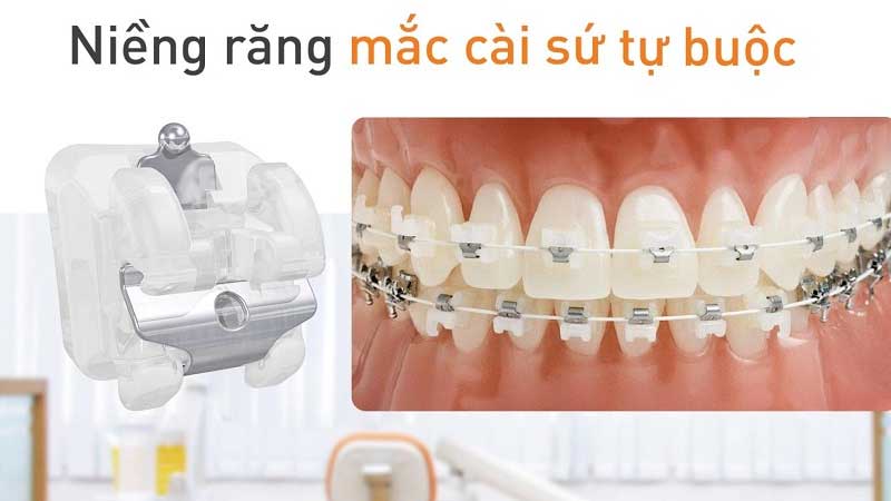 Nieng Rang Mac Cai Su Tu Buoc