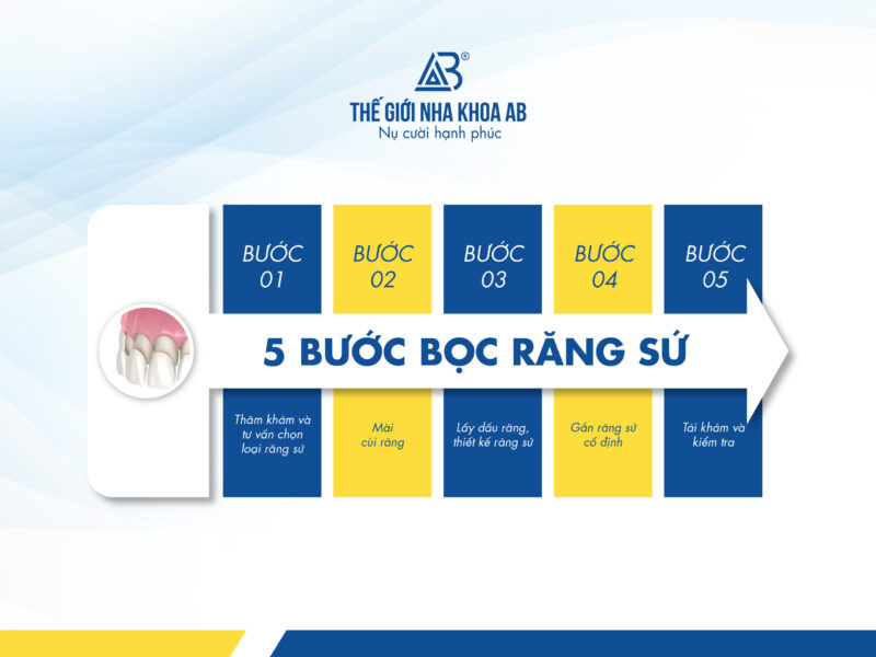 Quy Trinh Boc Rang Su