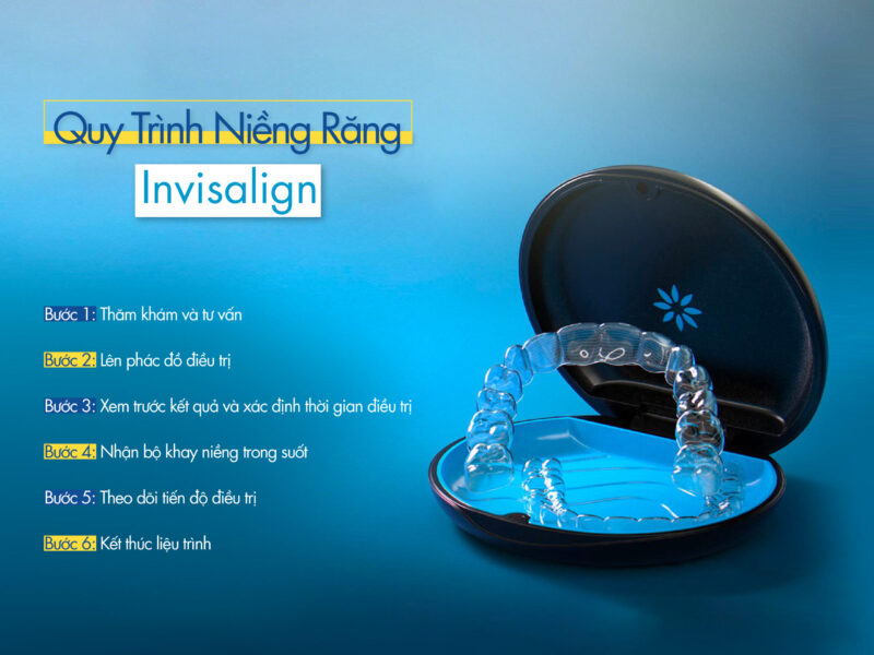 Quy Trinh Nieng Rang Invisalign