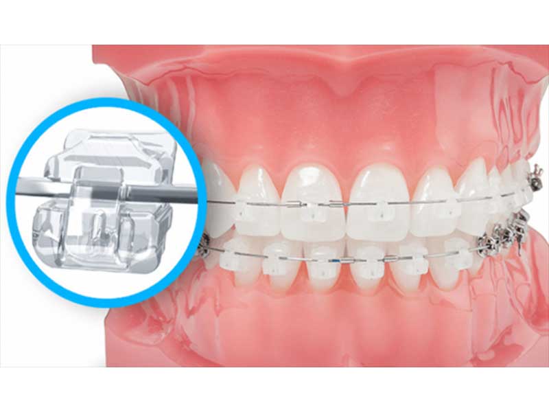 Thoi Gian Nieng Rang Mac Cai Su